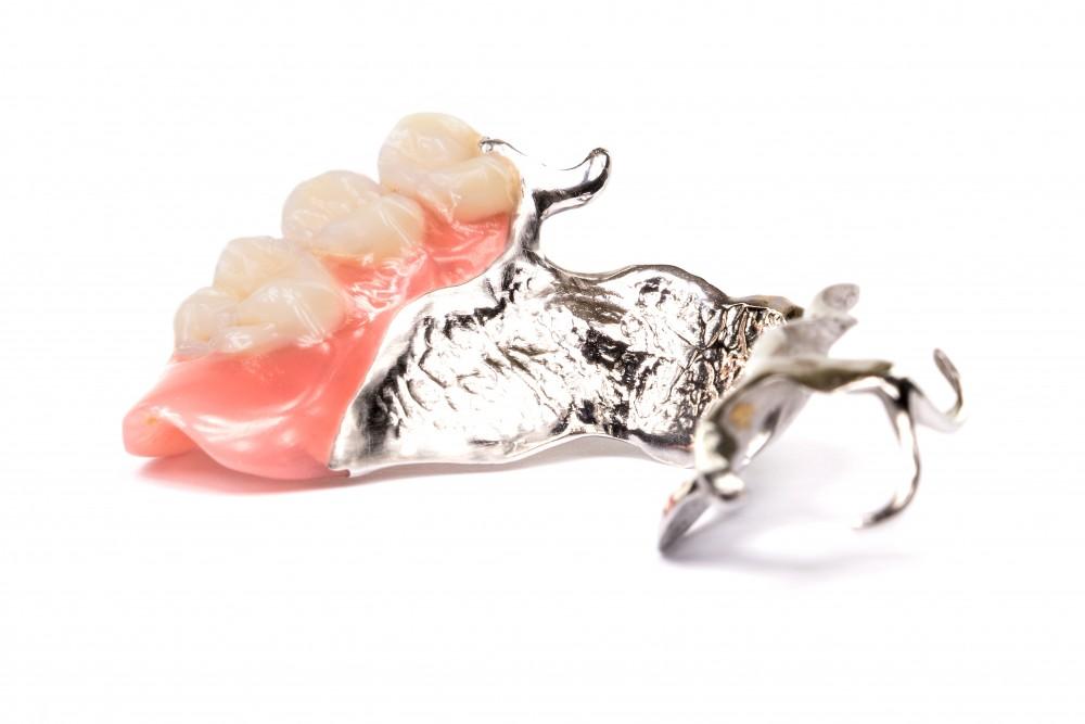Clinique de Denturologie Hidaye Suyum | 4901 Rue Beaubien E, Montréal, QC H1T 1V1, Canada | Phone: (438) 558-2946