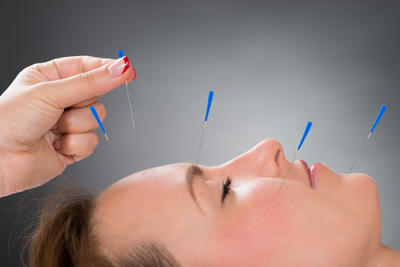 Clinique dAcupuncture Danielle Chapdelaine Sorel-Tracy | 83 Rue Phipps, Sorel-Tracy, QC J3P 4B8, Canada | Phone: (450) 746-0362