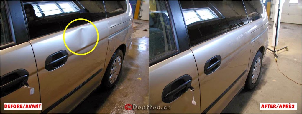 Dent Tec | 93 Rue Robert-Pilon, Gatineau, QC J9J 2X8, Canada | Phone: (819) 743-5252