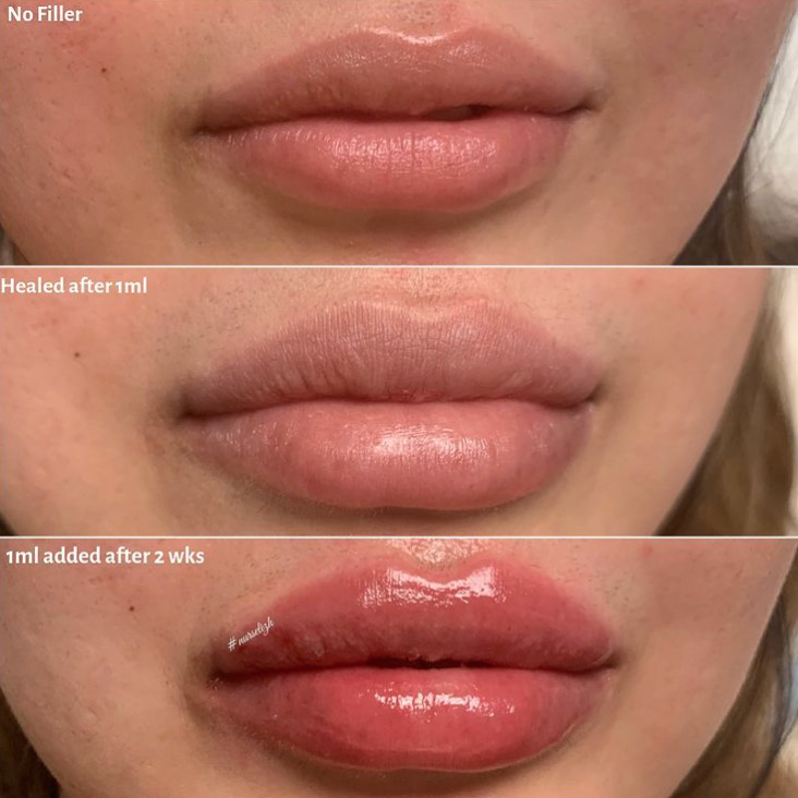 Dream Beauty Clinic | 170 N Queen St Unit K, Etobicoke, ON M9C 1A7, Canada | Phone: (289) 233-3929