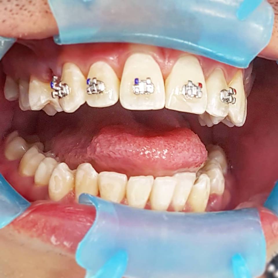 Nordic Dentistry | 465 Highland Rd W #3, Kitchener, ON N2M 3C6, Canada | Phone: (519) 208-4060