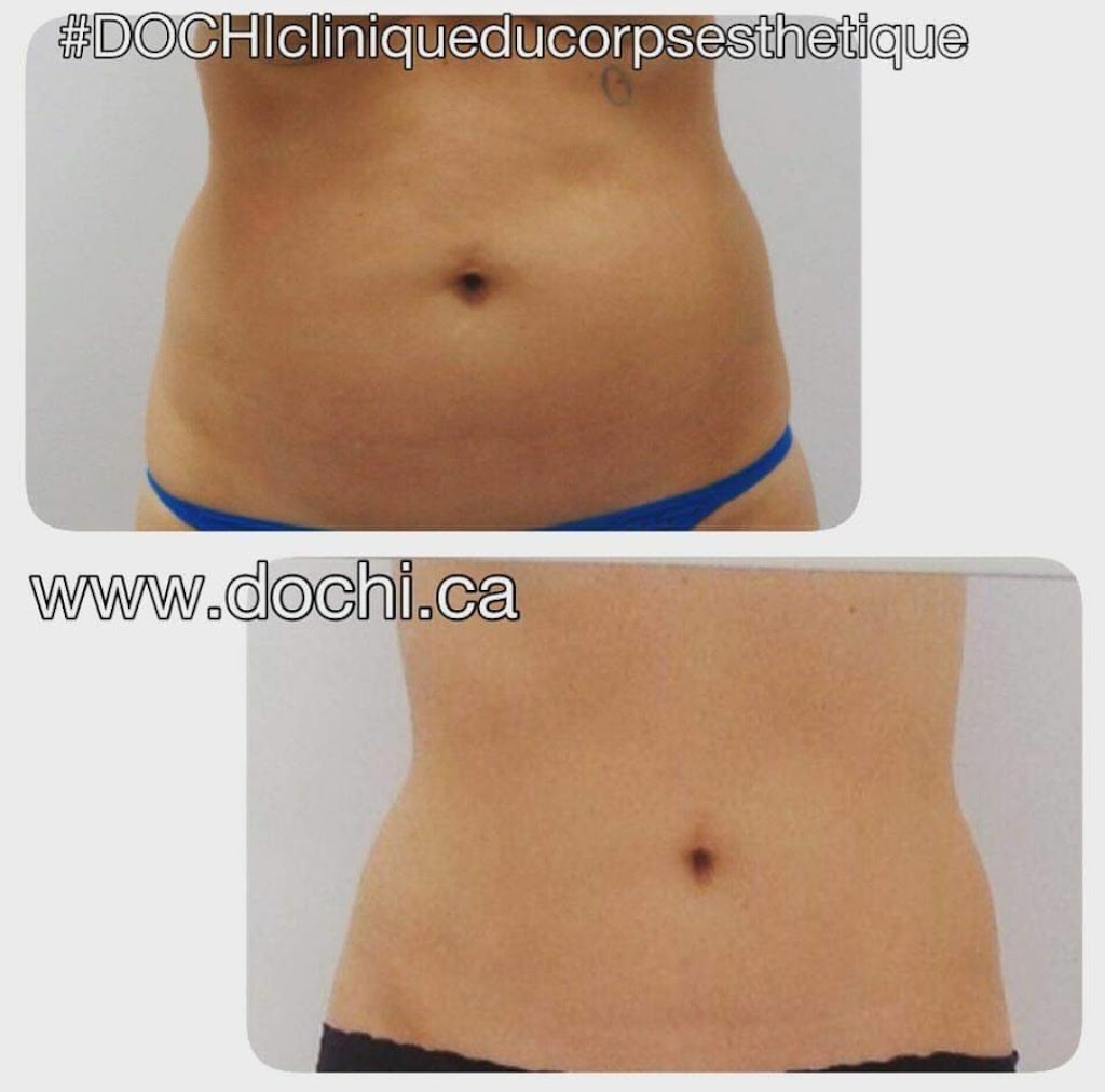 DOCHI clinique du corps | 2300 Blvd. Marcel-Laurin, Saint-Laurent, QC H4R 1J9, Canada | Phone: (514) 744-3222