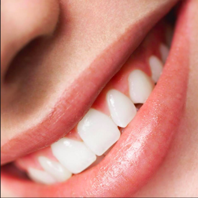 Todays Family Dental Centre | Dr. Joe Radice & Associates | 200 Marycroft Ave Unit 2, Woodbridge, ON L4L 5X4, Canada | Phone: (905) 850-9099