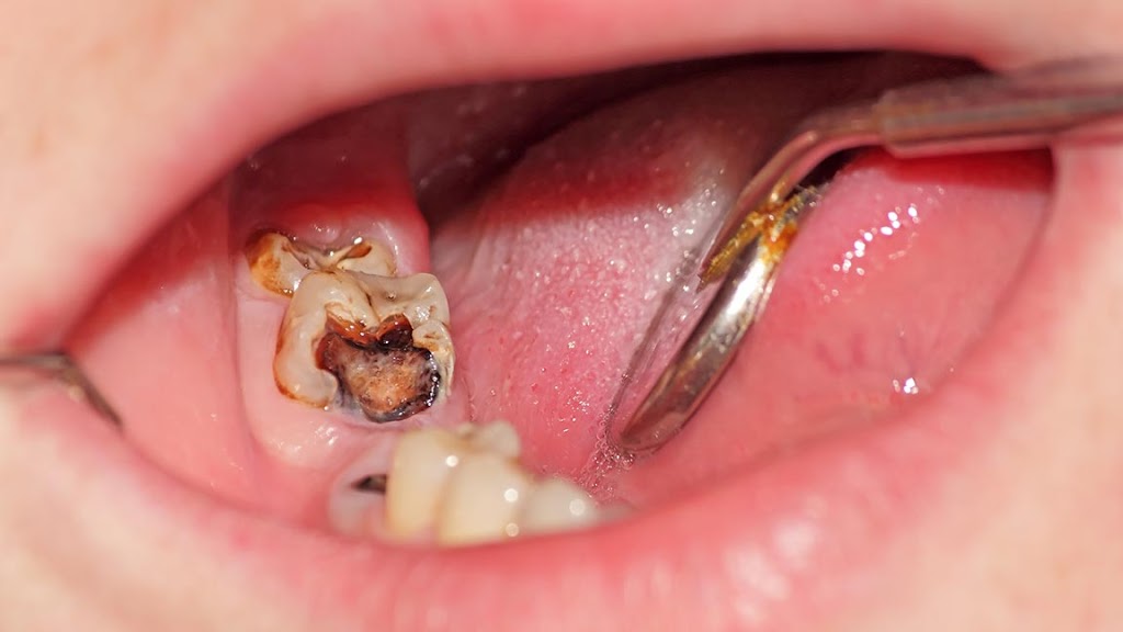 Emergency Dental Office | 7241 Bathurst St Unit 13, Thornhill, ON L4J 3W1, Canada | Phone: (905) 764-5399