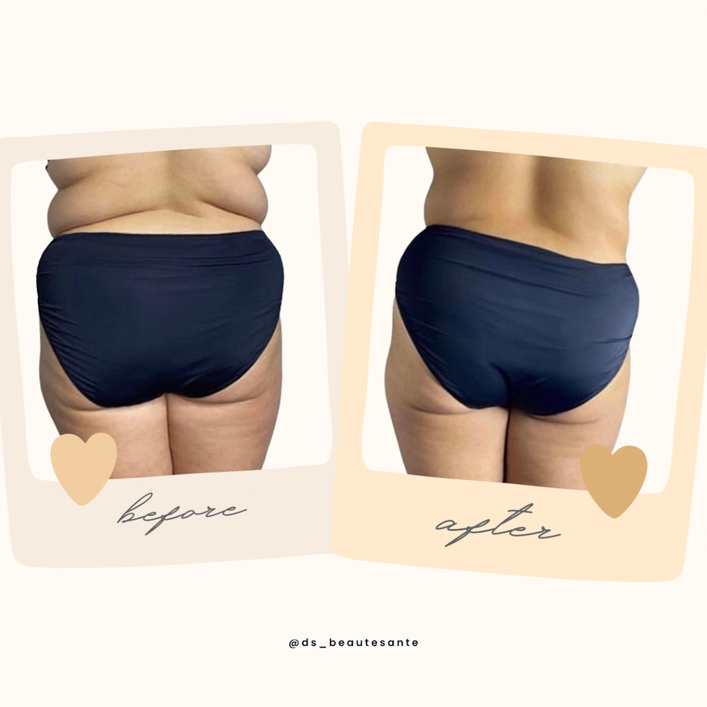 DS beauté santé | Slimwave, infratherapie, remodelage corporel, perte de poids naturelle et saine | 3495 Rue Bergerac, Brossard, QC J4Z 2M4, Canada | Phone: (438) 990-1906