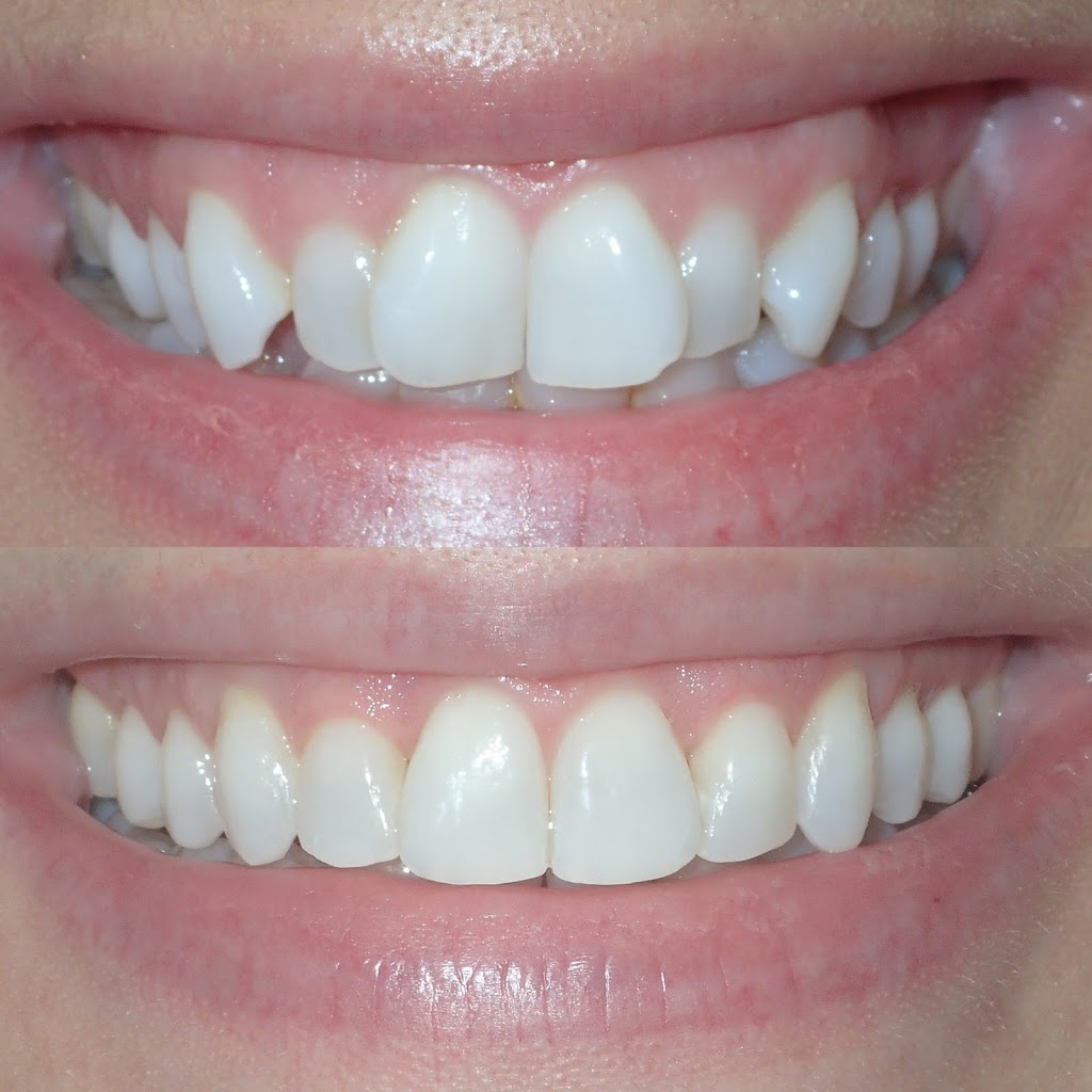 Singer Dental Ajax | dentist | 362 Kingston Rd W #1, Ajax, ON L1T 3A4, Canada | 9059033848 OR +1 905-903-3848