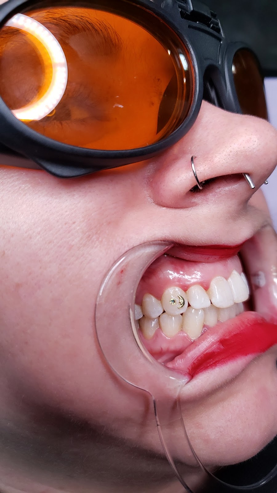Tooth gems by Amanda | Carriage Rd, Lincoln, ON L0R 1B5, Canada | Phone: (905) 329-2405