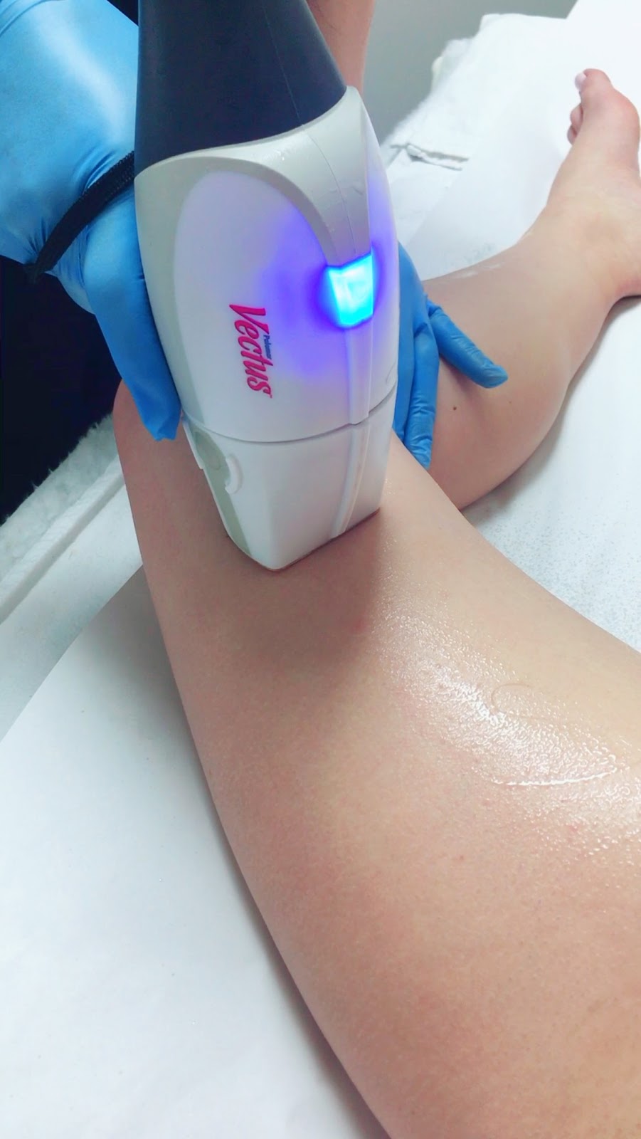 VIP laser & Esthetics | 355 Boulevard Samson, Laval, QC H7X 2Z7, Canada | Phone: (514) 796-2660