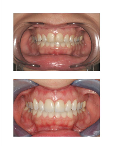 Clinique Dentaire Dac - Dentiste Westmount | 4141 Rue Sherbrooke Ouest #350, Westmount, QC H3Z 1B7, Canada | Phone: (514) 934-0748