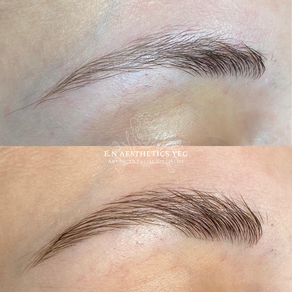 Lunar Medical Aesthetics | 31 Kingsbury Cir, Spruce Grove, AB T7X 0C9, Canada | Phone: (780) 920-9981