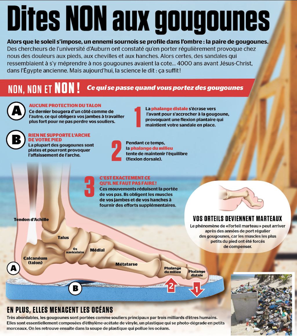 Orthèse GO Clermont - Malbaie | 24 Rue du Foyer, Clermont, QC G4A 1H3, Canada | Phone: (418) 633-4351