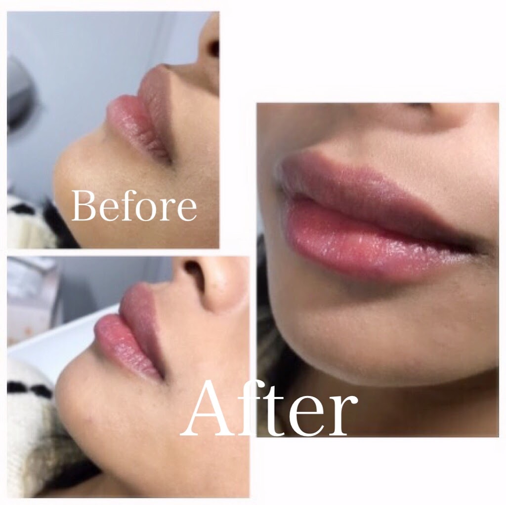 Let Them Notice - Botox Clinic Toronto/Etobicoke | 170 North Queen Street K, Unit 20, Toronto, ON M9C 1A8, Canada | Phone: (416) 904-6653