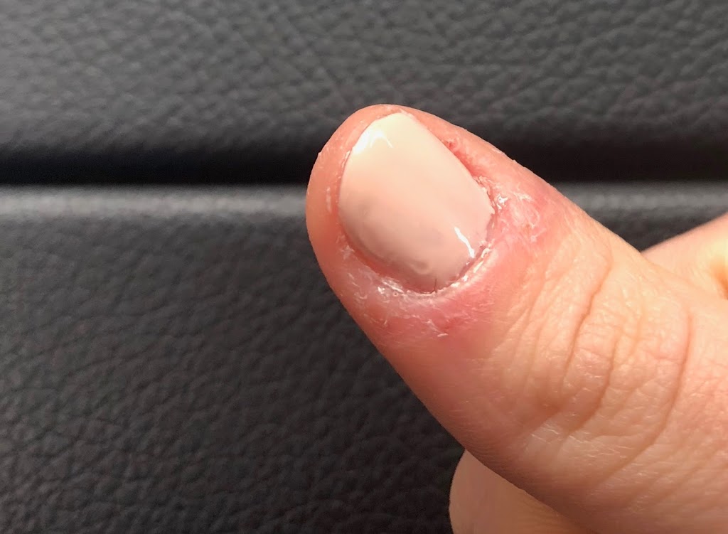 A Perfect Pinky | 15450 Yonge St, Aurora, ON L4G 0K1, Canada | Phone: (905) 713-1814