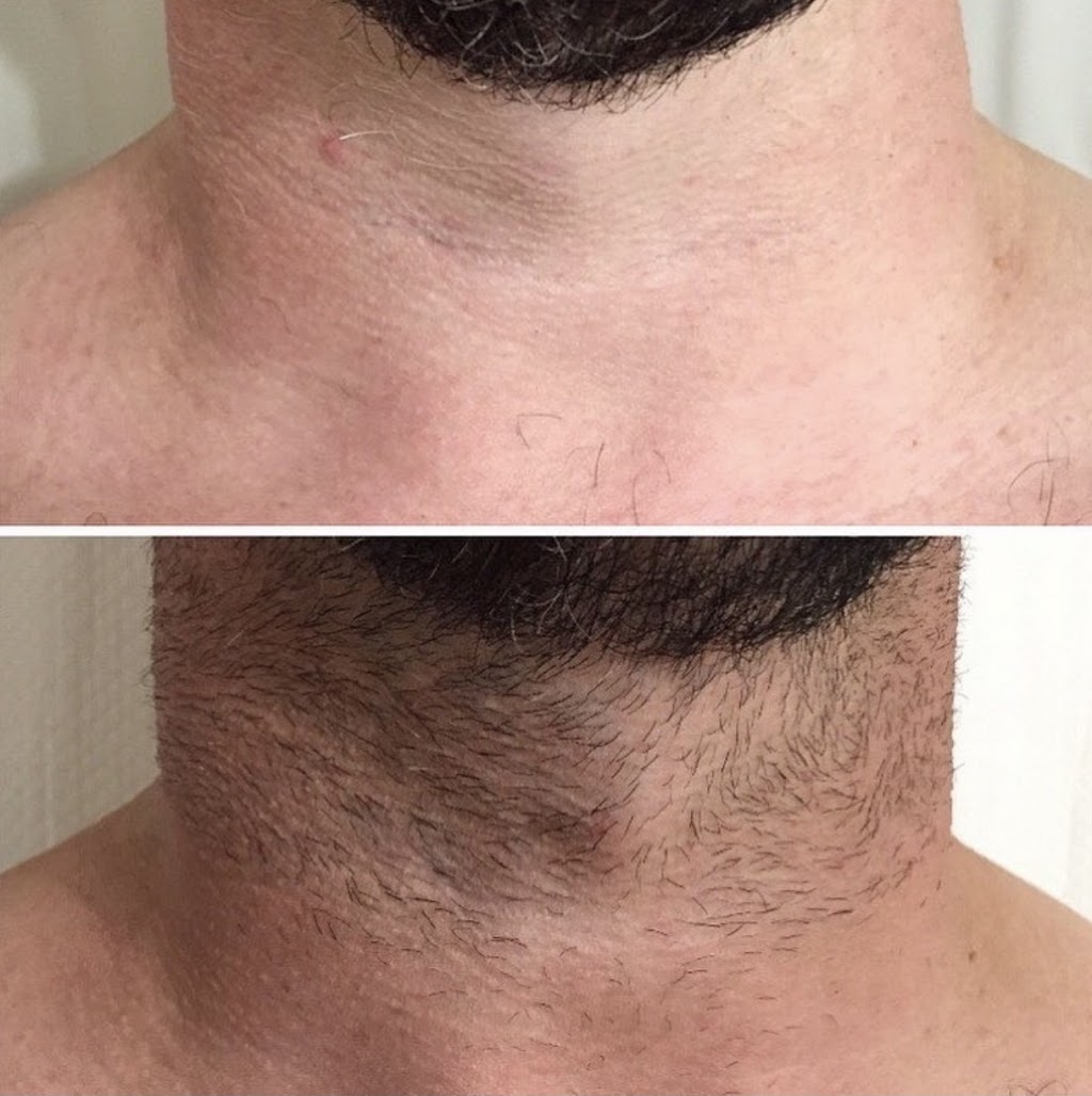 Laser And Lash Clinic | 633 King St E unit# 206, Oshawa, ON L1H 1G3, Canada | Phone: (416) 896-5274