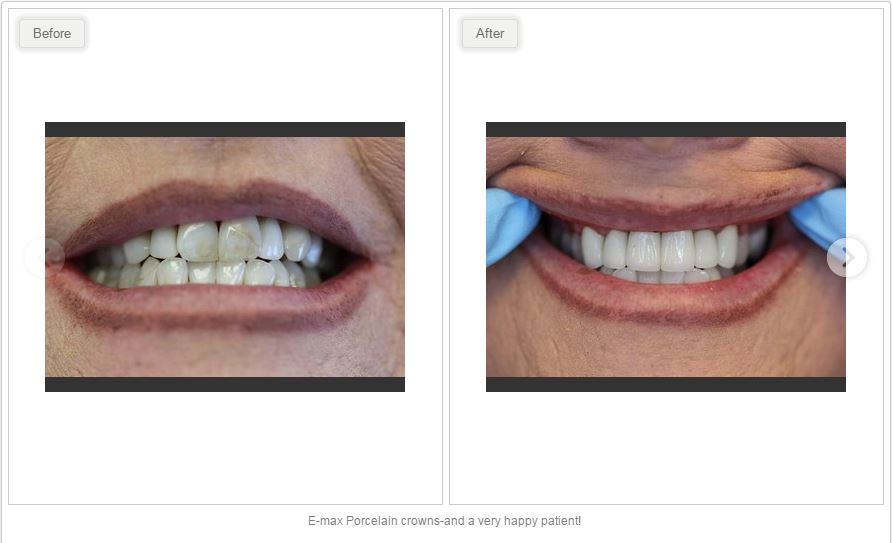 Clearview Market Dental Care | 47 Clearview Market Way #100, Red Deer, AB T4P 0M9, Canada | Phone: (403) 346-7878