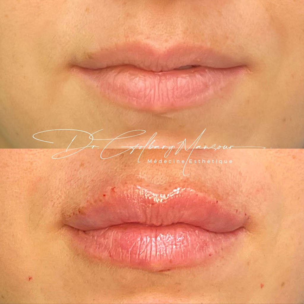 Clinique Esthétique HoMa - Dr. Golbarg Mansour | 4514 Rue Sainte-Catherine E, Montréal, QC H1V 1Y5, Canada | Phone: (514) 500-5805