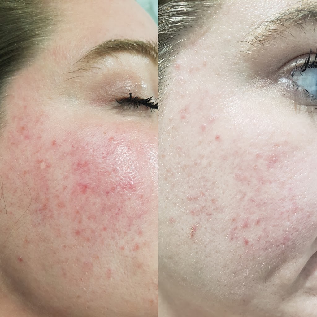 Laser Clinic and Spa | 35 Winchester Rd E, Whitby, ON L1M 1B4, Canada | Phone: (647) 922-9308