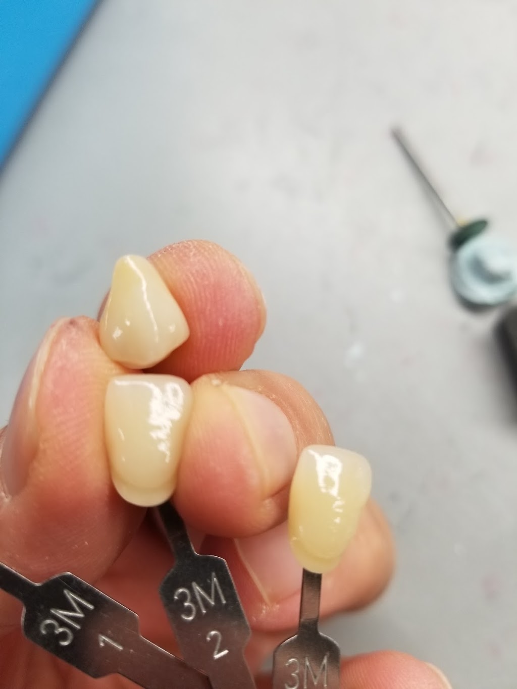 J169 Dental Design Inc | 181 Sablewood Rd, Winnipeg, MB R3Y 0H8, Canada | Phone: (204) 417-2924