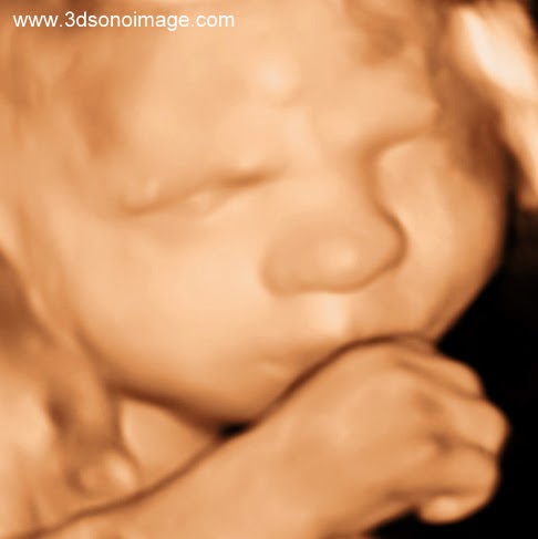 PCRM Fertility Clinic - Burnaby | 4601 Canada Way #500, Burnaby, BC V5G 4X7, Canada | Phone: (604) 422-7276