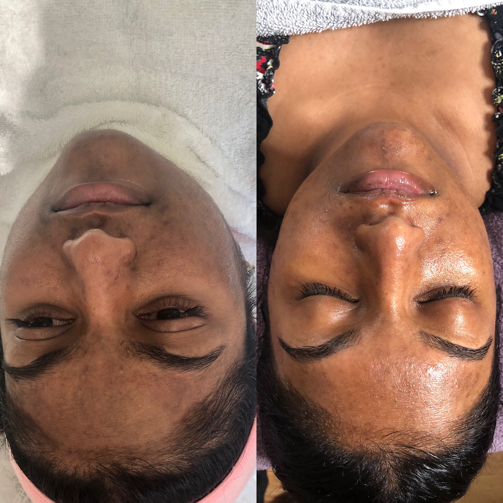 AVÄYA Skin | 875 Bank St suite 3, Ottawa, ON K1S 3W4, Canada | Phone: (647) 963-0550