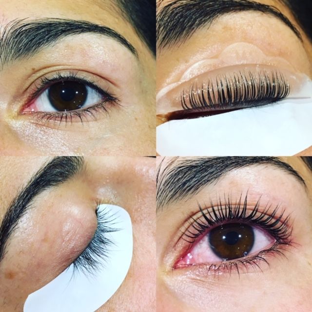 Esthetique Sainte-Thérèse Epilation au Laser Julie Levasseur | 317 Bd du Curé-Labelle, Sainte-Thérèse, QC J7E 2Y2, Canada | Phone: (514) 264-6065