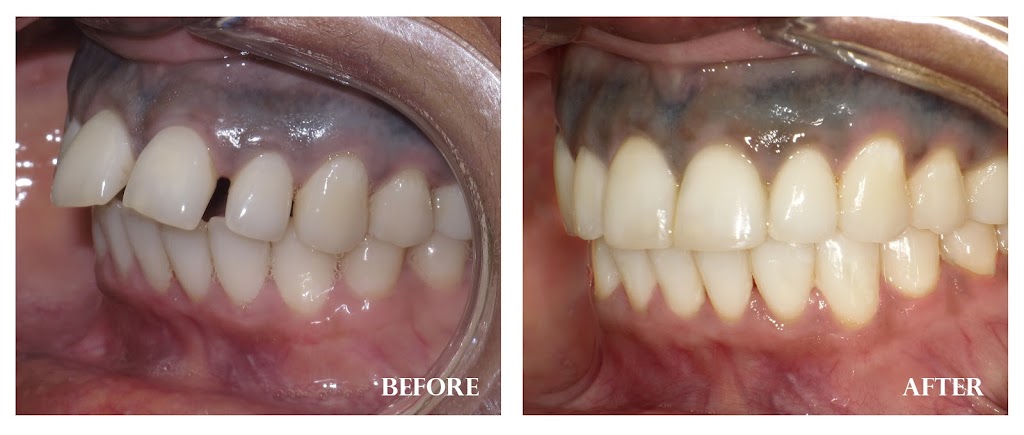 Elmwood Park Dental | 29 Elm St, Toronto, ON M5G 1H1, Canada | Phone: (416) 971-8181