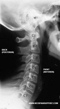 Life Chiropractic Centre | 8-2501 Guelph Line North, Burlington, ON L7M 2A3, Canada | Phone: (905) 335-5433
