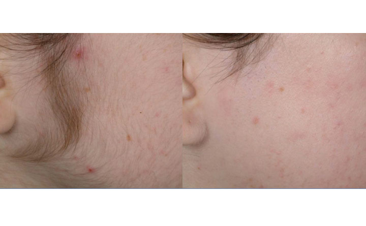 Touch of Beauty | 139 Inspire Blvd, Brampton, ON L6R 0B3, Canada | Phone: (905) 793-8889