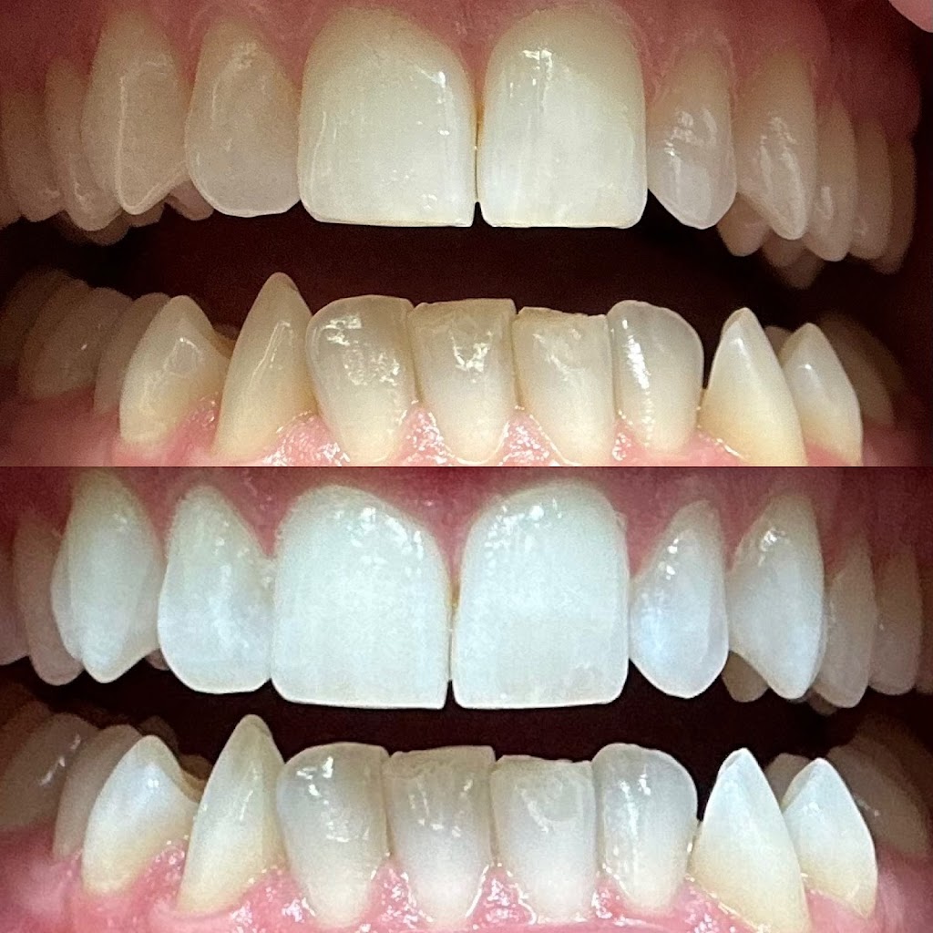 Bleachedandbronzed | Club Rd, Brookside, NS B3T 1R6, Canada | Phone: (902) 403-1494