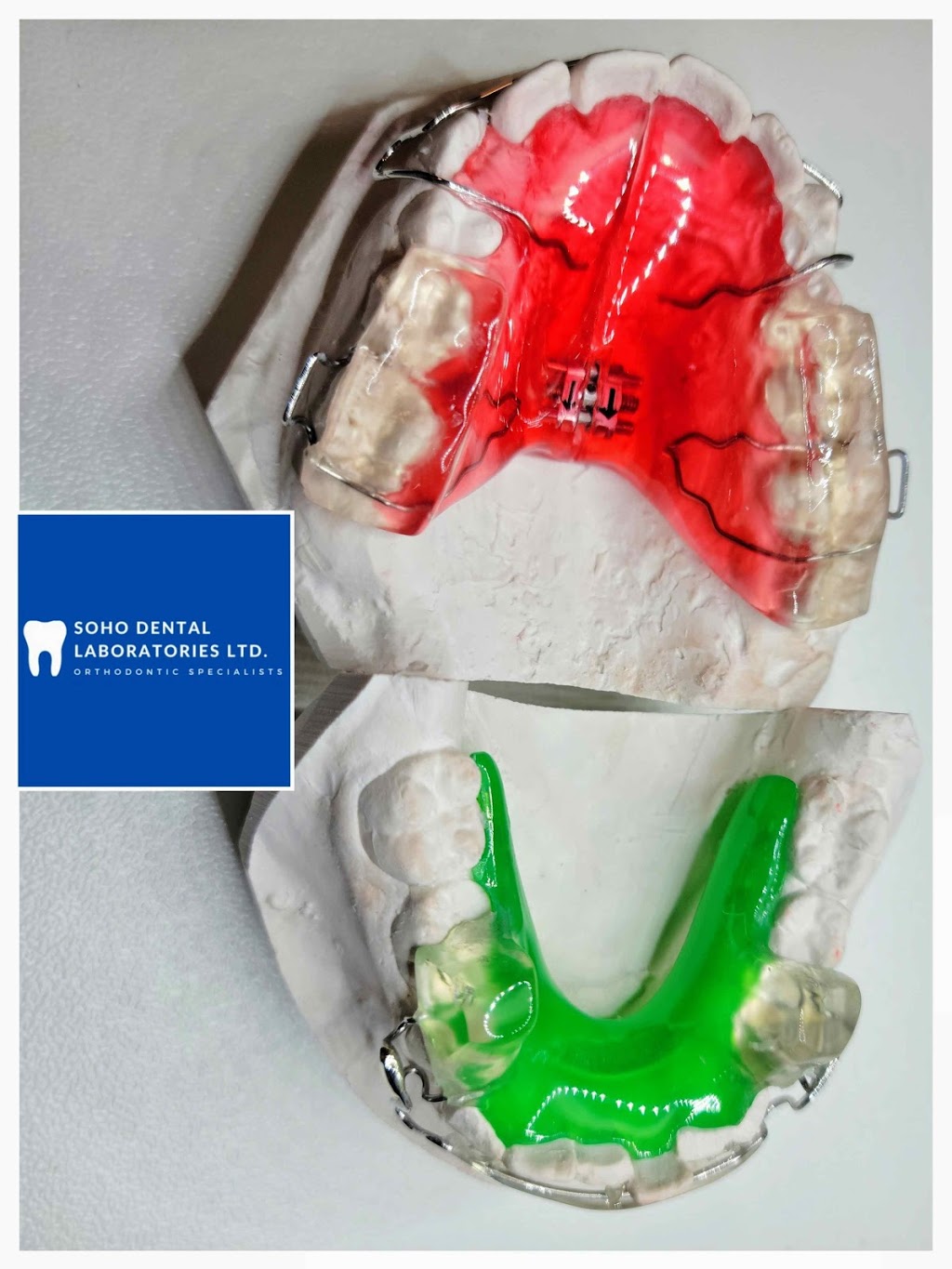 Soho Dental Laboratories Ltd | 4008 Deane Pl, North Vancouver, BC V7G 2P3, Canada | Phone: (604) 722-4855
