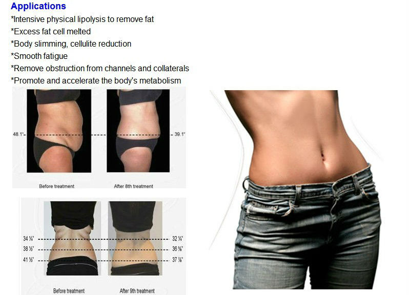 BLUEWATER LASER | 1583 Sixth St, Courtright, ON N0N 1H0, Canada | Phone: (519) 383-3078