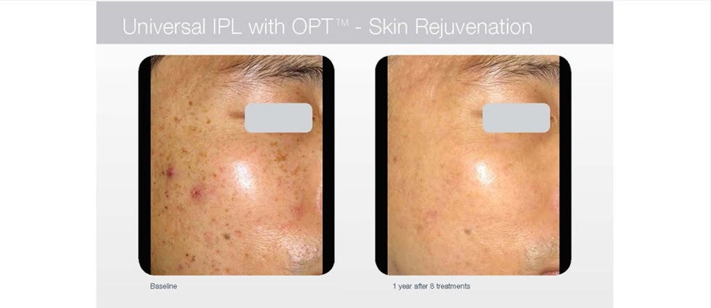 Beautique Laser Spa | 398 Steeles Ave W Unit #3, Thornhill, ON L4J 6X3, Canada | Phone: (416) 877-4348