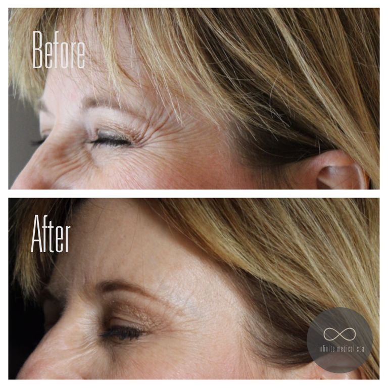 Infinite Medical Spa | 551 Oxford St W Unit 201, London, ON N6H 0H9, Canada | Phone: (519) 709-6494