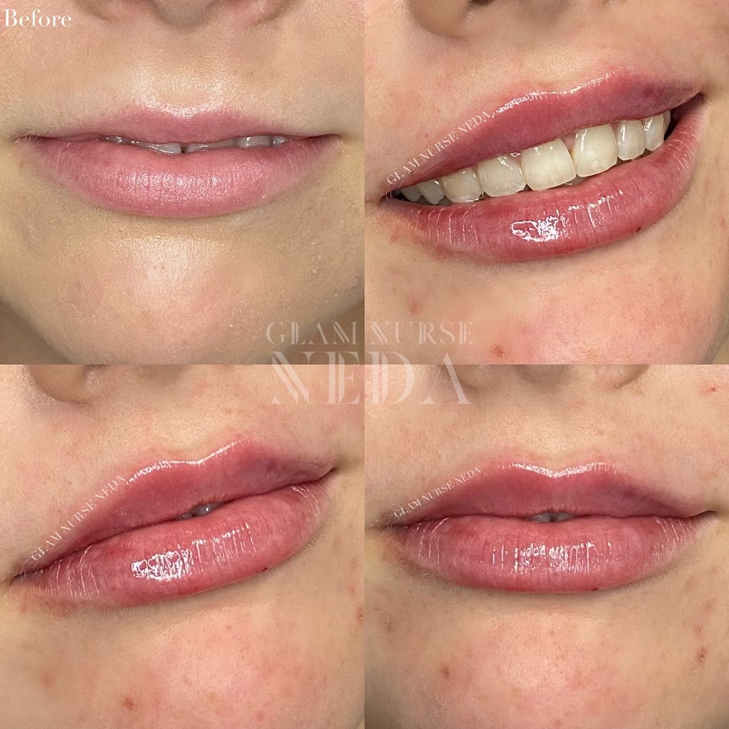 Bespoke Medical Aesthetics | 446 Winston Rd, Grimsby, ON L3M 0H2, Canada | Phone: (289) 442-1419