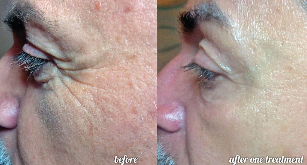 The Skin Klinic | 73 Warren Rd #100, Toronto, ON M4V 2R9, Canada | Phone: (647) 439-3806