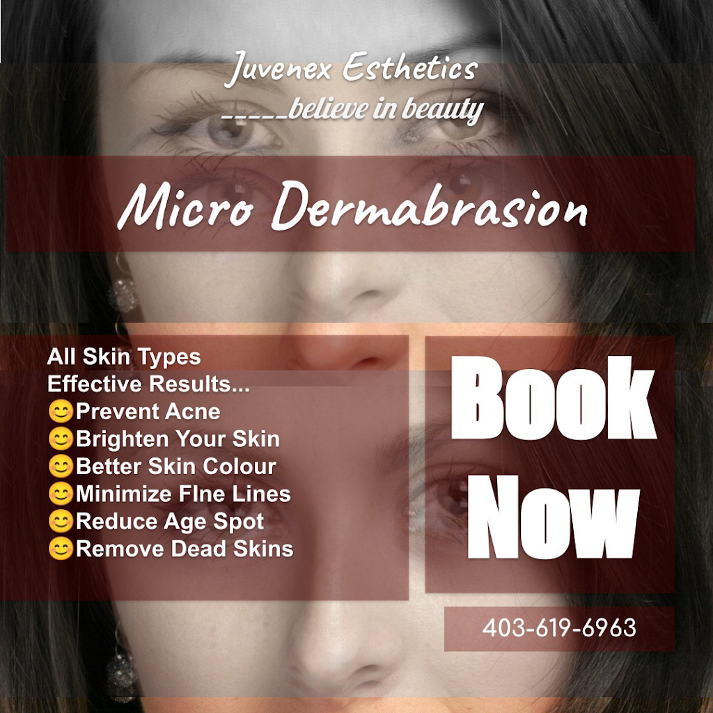 Juvenex Esthetics Evanston | Evansfield Cl NW, Calgary, AB T3P 1V6, Canada | Phone: (403) 619-6963