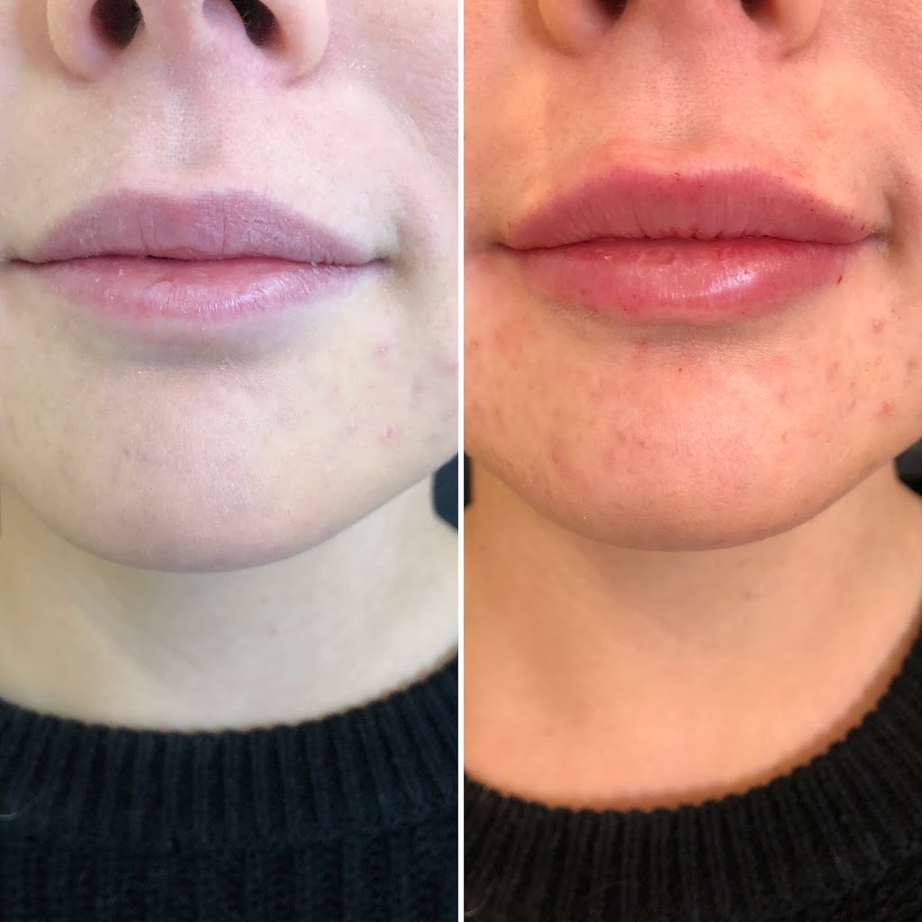 Amara Medical Aesthetics | 670 Upper James St, Hamilton, ON L9C 2Z3, Canada | Phone: (289) 674-9577