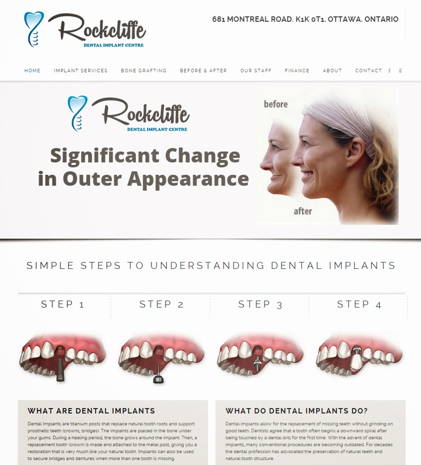 DENTAL IMPLANTS OTTAWA - DR. KONIOUCHINE | 681 Montréal Rd, Ottawa, ON K1K 0T1, Canada | Phone: (613) 746-5050