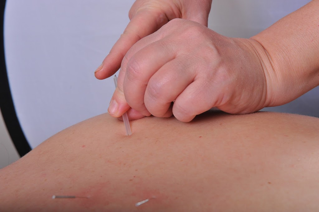 Live by Design | Acupuncture & Massage Edmonton | 15307 96 Ave NW, Edmonton, AB T5P 4L8, Canada | Phone: (780) 443-0099