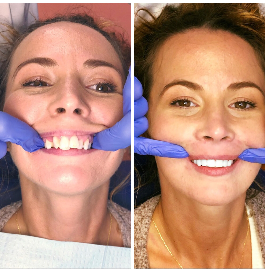 Artistic Dentists of Bellingham at Bellwether Dental | 12 Bellwether Way Ste 114, Bellingham, WA 98225, USA | Phone: (360) 366-8026