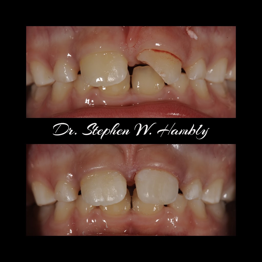Ancaster Dental Care | 34 Stone Church Rd Suite 202, Ancaster, ON L9K 1S5, Canada | Phone: (905) 304-3479