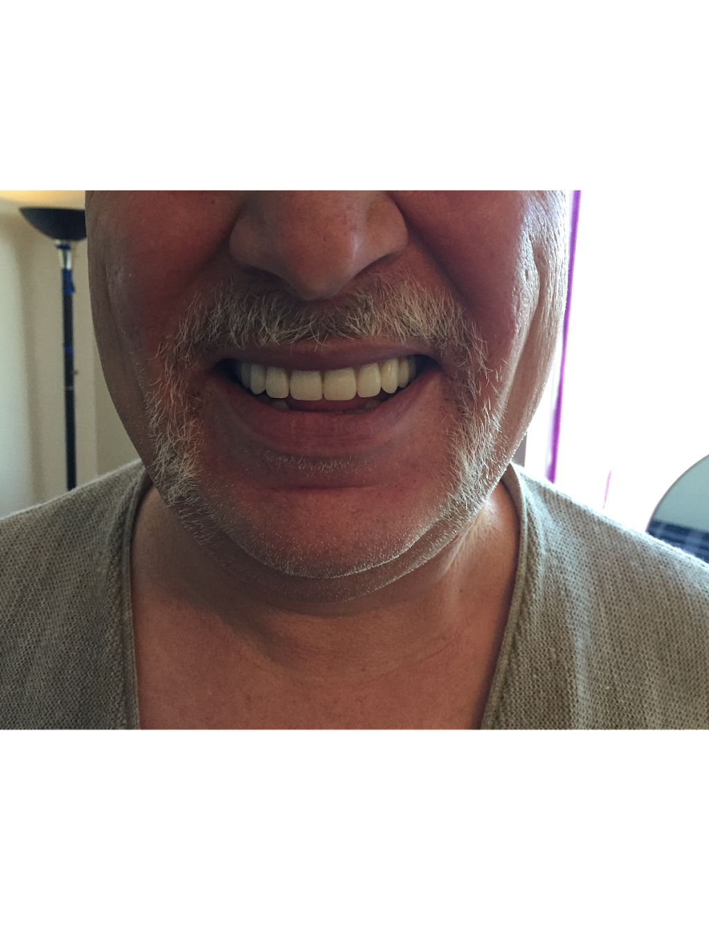Denture Homecare | 7710 5 St SE Unit 109, Calgary, AB T2H 2L9, Canada | Phone: (403) 399-3985