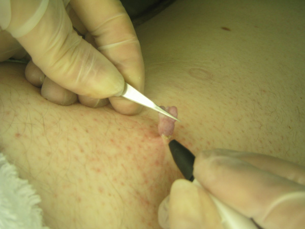 Lasting Touch Skincare Electrolysis & Day Spa | 310 Albert Ave N, Listowel, ON N4W 1T9, Canada | Phone: (519) 291-4444
