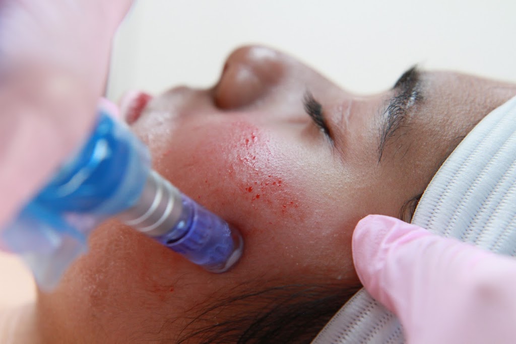 FM Aesthetics Inc. | 21 Glendinning Ave, Scarborough, ON M1W 3E2, Canada | Phone: (647) 873-2389
