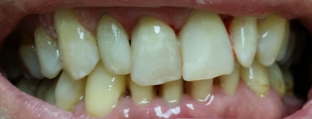 Kenedy Ruth Dental Centre | 27 Ruth Ave, Brampton, ON L6Z 4R2, Canada | Phone: (905) 846-1595