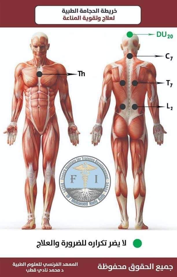 Hijama montreal clinic | 5805 Rue Lauzon, Montréal-Nord, QC H1G 2G9, Canada | Phone: (438) 221-5070