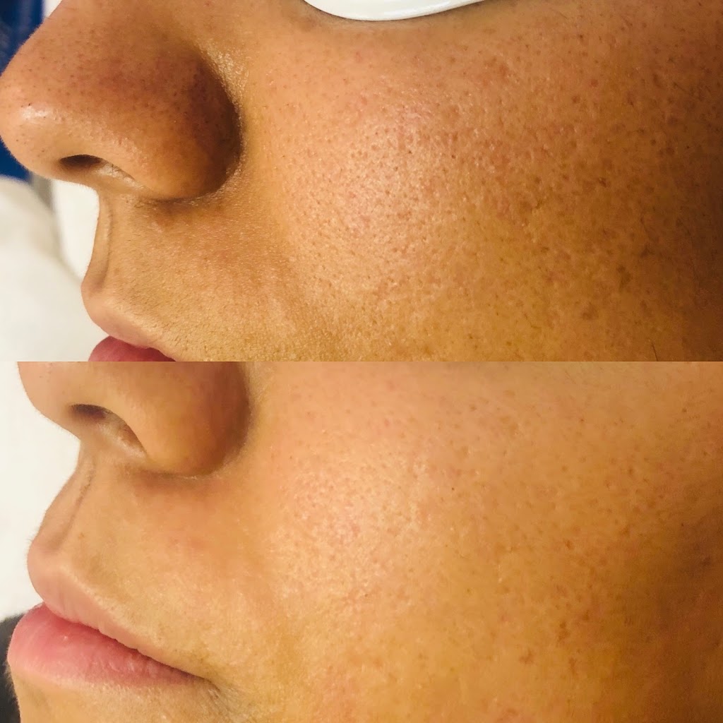 Anava Esthetics Studio Ltd | 9 Fairway Dr NW, Edmonton, AB T6J 2S6, Canada | Phone: (780) 432-3245