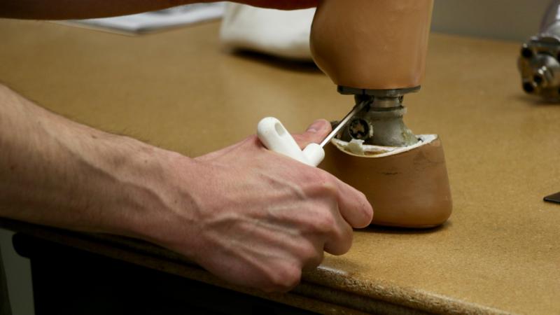 Prosthetic Energy West | 8-90 CLAIRE PORT CRES, Etobicoke, ON M9W 6P4, Canada | Phone: (905) 624-9293