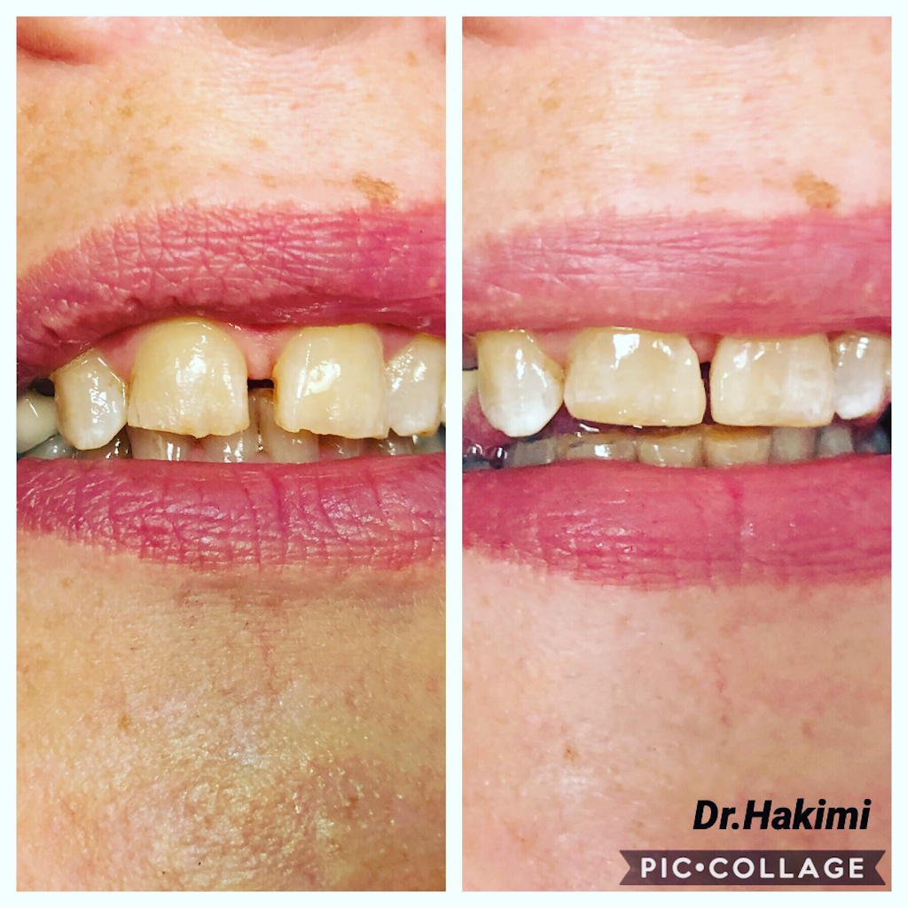 Glen Park Dental | 1135 Pipeline Rd #105, Coquitlam, BC V3B 0N3, Canada | Phone: (604) 474-0403