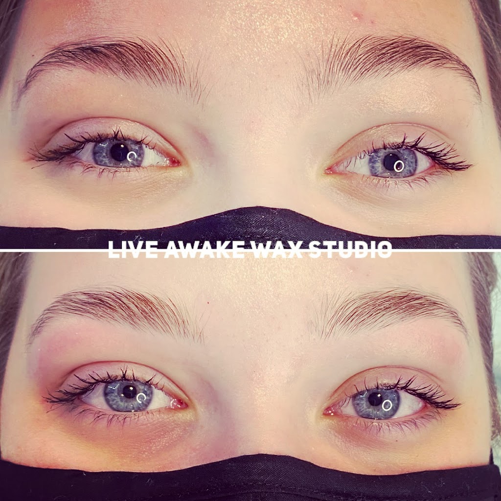 Live Awake Wax Studio & Laser Hair Removal | 20503 42 Ave, Langley, BC V3A 3A8, Canada | Phone: (604) 720-5445